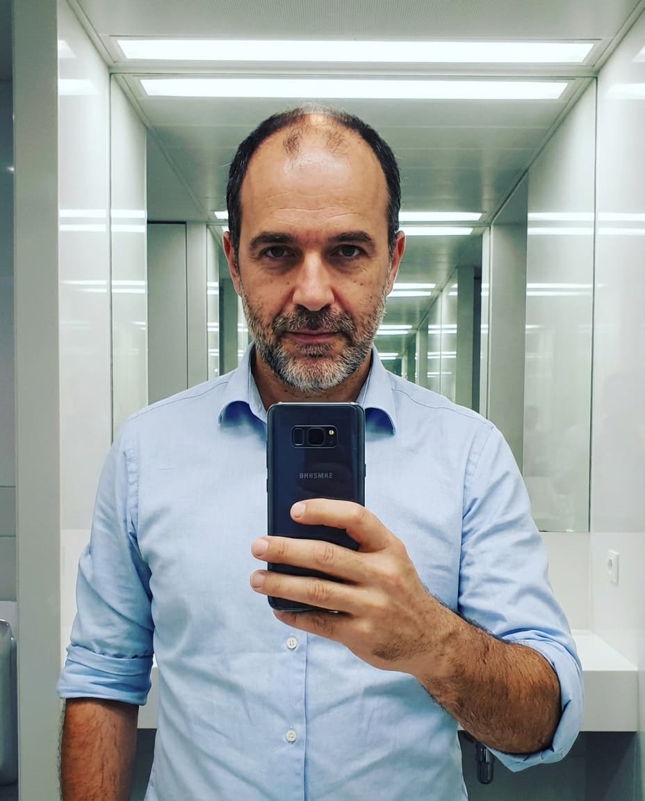 Voor — Peter, 47 — 20 weken