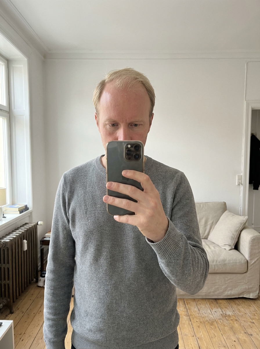 Vorher — Erik, 41 — 20 Wochen
